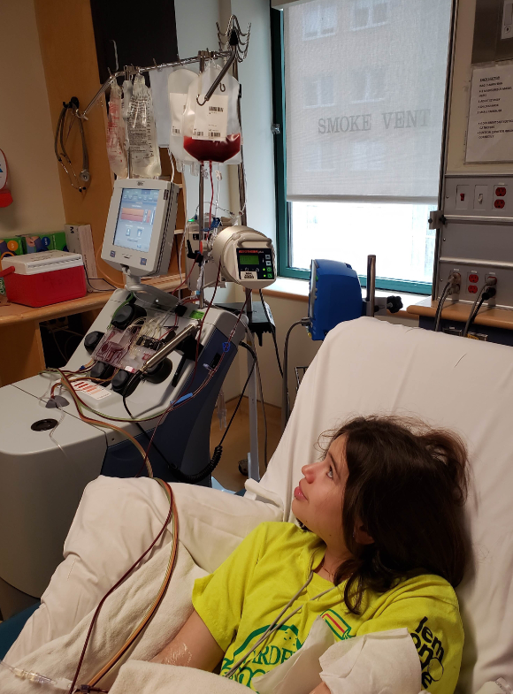 Abby watches as her stem cells collect in a bag hung on the Apheresis machine in the Dialysis Unit at Sick Kids Hospital on March 31st, 2020. The lines running her blood through the machine to strip out her stem cells can be seen beside her.