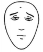 Cartoon face showing mild pain